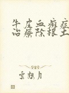 牛皮血癣症怎么治疗除根土方