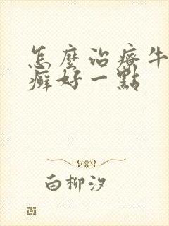 怎么治疗牛皮有癣好一点