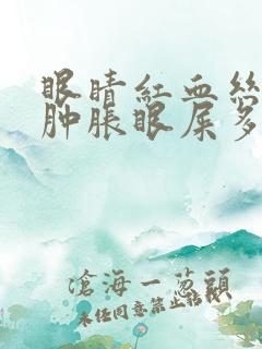 眼睛红血丝眼袋肿胀眼屎多