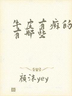 牛皮有癣的病因有哪些