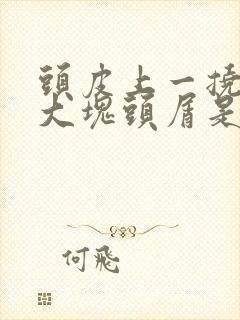 头皮上一挠就一大块头屑是怎么回事