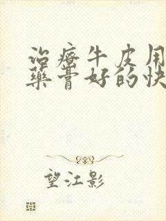 治疗牛皮用什么药膏好的快一点