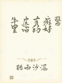 牛皮有癣医院哪里治的好