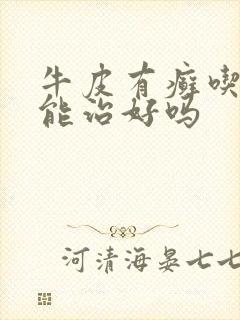 牛皮有癣吃中药能治好吗