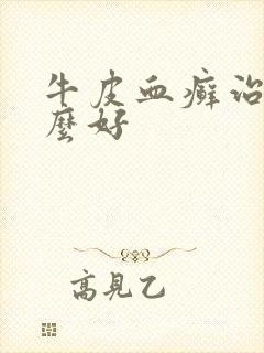 牛皮血癣治疗什么好