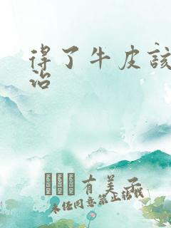 得了牛皮该怎么治