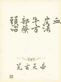 头部牛皮血癣的治疗方法