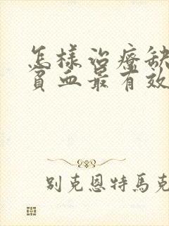 怎样治疗缺铁性贫血最有效