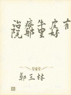 治疗牛皮有癣医院那里好