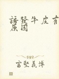 诱发牛皮有癣的原因