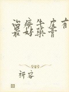 治疗牛皮有癣的最好药膏