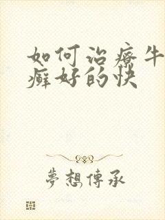 如何治疗牛皮有癣好的快