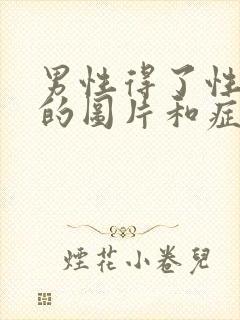 男性得了性疾病的图片和症状