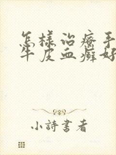 怎样治疗手上长牛皮血癣好