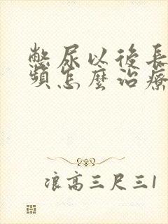 憋尿以后长期尿频怎么治疗