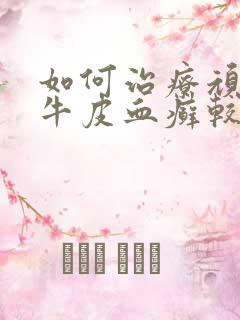 如何治疗顽固性牛皮血癣较好