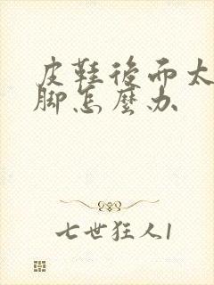 皮鞋后面太硬磨脚怎么办