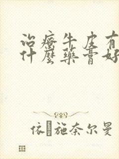 治疗牛皮有癣用什么药膏好