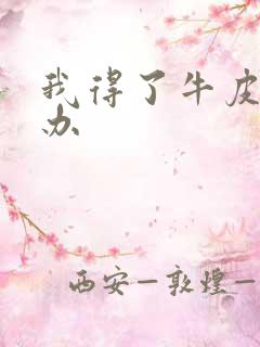 我得了牛皮怎么办