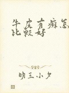 牛皮有癣怎么治比较好