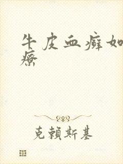 牛皮血癣如何治疗