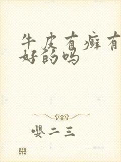 牛皮有癣有治疗好的吗