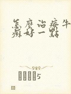 怎么治疗牛皮有癣好一点