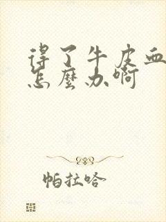 得了牛皮血癣该怎么办啊