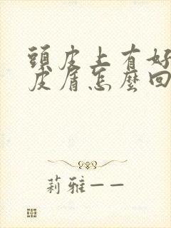 头皮上有好多头皮屑怎么回事