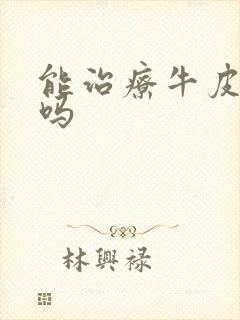 能治疗牛皮血癣吗