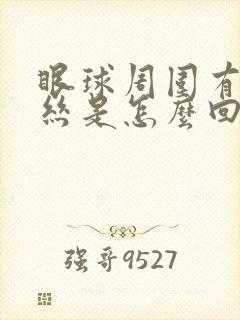 眼球周围有红血丝是怎么回事