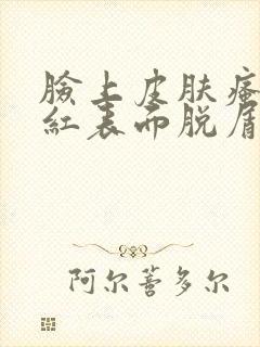 脸上皮肤瘙痒发红表面脱屑