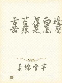 舌苔厚白边缘有齿痕是怎么回事