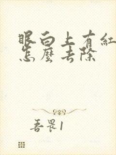 眼白上有红血丝怎么去除