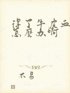 得了牛皮血癣该怎么办啊