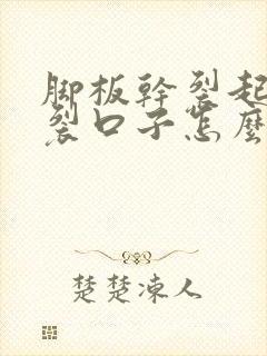 脚板干裂起硬皮裂口子怎么办