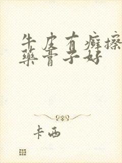 牛皮有癣擦什么药膏子好