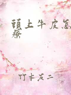 头上牛皮怎么治疗