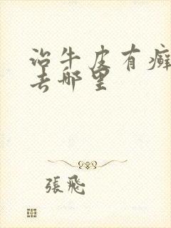 治牛皮有癣医院去哪里