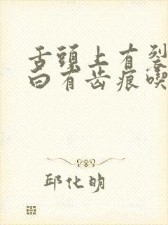 舌头上有裂纹发白有齿痕吃什么药治疗