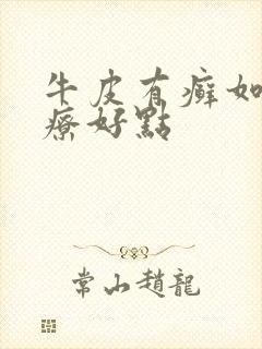 牛皮有癣如何治疗好点