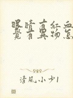 眼睛有红血丝感觉有异物怎么回事