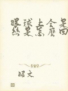 眼球上全是红血丝是怎么回事