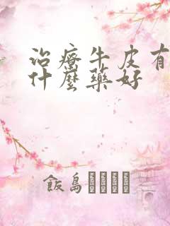 治疗牛皮有癣用什么药好