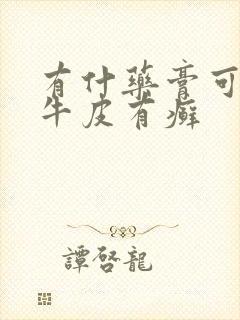 有什药膏可以治牛皮有癣