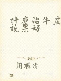 什么治牛皮血癣效果好