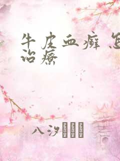 牛皮血癣 怎么治疗