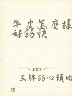 牛皮怎么样治疗好的快