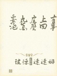 睾丸皮上有小水泡怎么回事