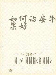 如何治疗牛皮效果好